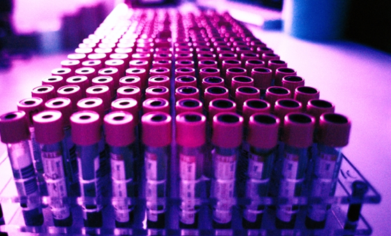 Anémie et nutrition chez les personnes ménopausées