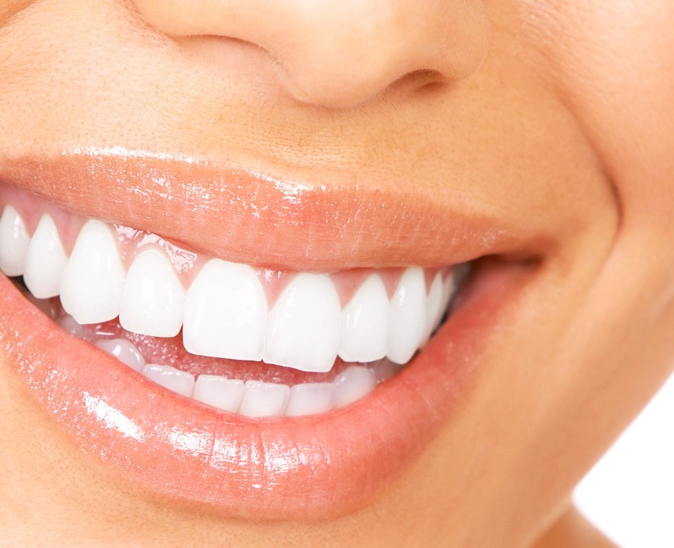 La carie dentaire est la troisième pathologie la plus répandue dans le monde.