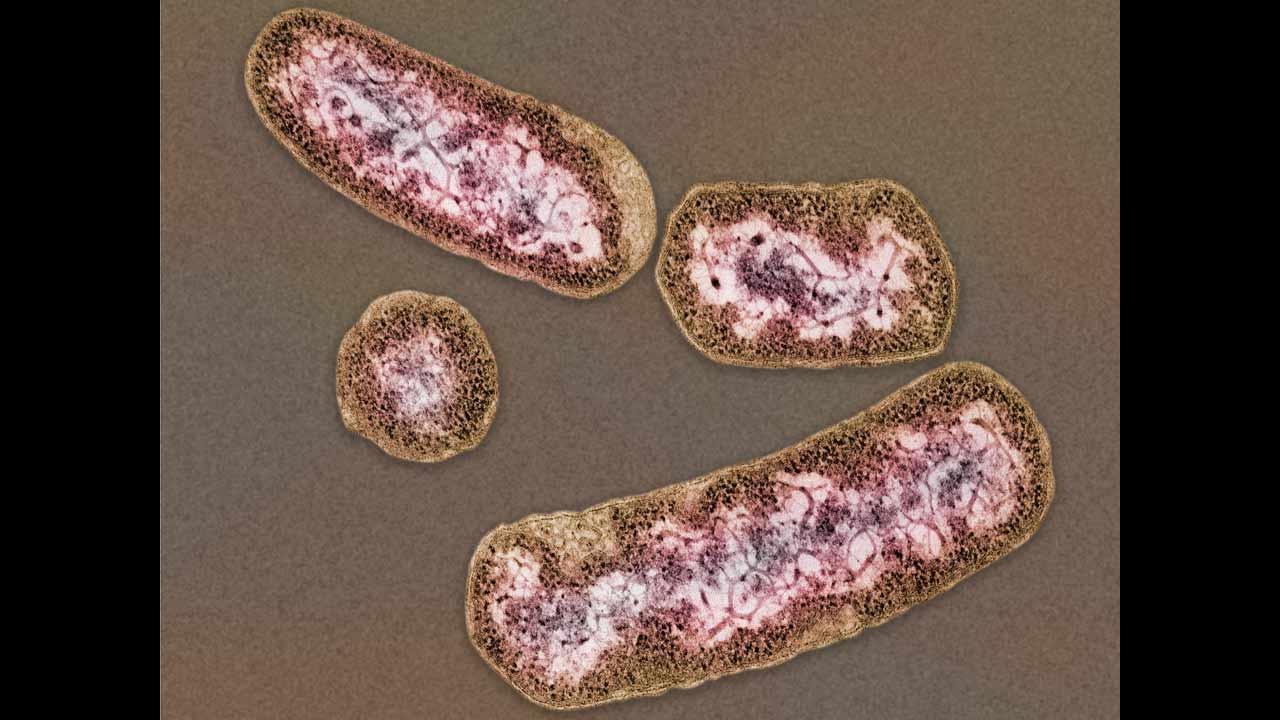 Une forte proportion de bactéries Prevotella entraîne une perte de poids