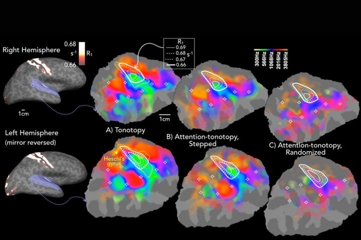Cartographie de l’attention sélective auditive du cerveau